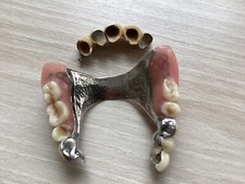 Altes gebiss zahnprothese gebraucht kaufen  Dortmund