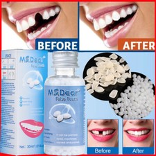Kit temporário de grânulos de reparo dentário contas de encaixe reutilizáveis moldáveis dentes falsos comprar usado  Enviando para Brazil
