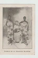 Woman africa albinos. d'occasion  Expédié en Belgium