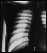 Xray human chest gebraucht kaufen  Versand nach Germany