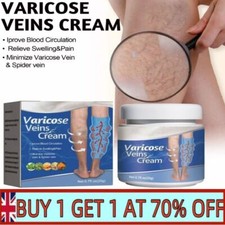 Varicose veins treatment for sale  LEICESTER