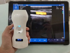 Tragbare ultraschallgerät wir gebraucht kaufen  Hamburg