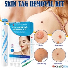 Kit D'Élimination des Acrochordons Stylo D'Élimination des Acrochordons 2 in 1, usado comprar usado  Enviando para Brazil