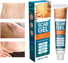 Scar removal cream for sale  GRAYS