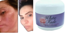 CREME DESBOTADO BRANCO: ELIMINAN LAS MANCHAS OSCURAS DE LA PIEL EN SOLO 2 SEMANAS 2oz comprar usado  Enviando para Brazil