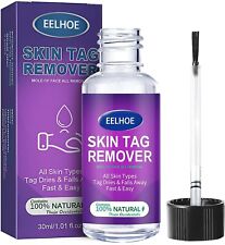 Skin tag removal for sale  BRADFORD