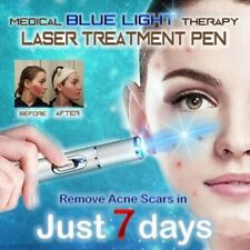 Caneta de beleza luz azul terapia varizes acne caneta laser remoção de cicatrizes beleza  comprar usado  Enviando para Brazil