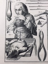 Trépanation 1779 neurologie d'occasion  Tuchan
