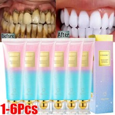 Niacinamide whitening toothpas for sale  DERBY
