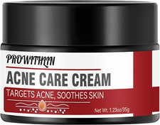 Cream anti acne d'occasion  Besançon
