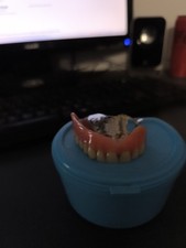 Denture denture top d'occasion  Expédié en Belgium