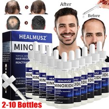 Minoxidil hair regrowth for sale  DERBY