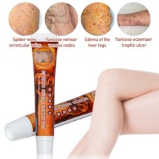 100 original vasculitis for sale  CORBY