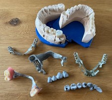 Zahnprothese dentalschrott gol gebraucht kaufen  Mülheim an der Ruhr