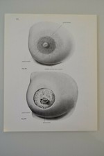 PLANCHE D'ANATOMIE HUMAINE LA PEAU ATLAS Dr SOBOTTA MEDECINE SCIENCE comprar usado PLANCHE D'ANATOMIE HUMAINE LA PEAU ATLAS Dr SOBOTTA MEDECINE SCIENCE comprar usado  Enviando para Brazil