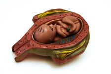 Vintage Artisanal Anatomie Modèle Du Utérus Et Foetus Éducatif Décor Rare comprar usado  Enviando para Brazil