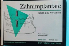 Zahnimplantate verstehen zahnm gebraucht kaufen  Bischofsheim
