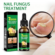 Ginger nail treatment for sale  Shipping to United Kingdom