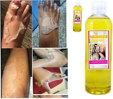 Yollow peeling oil d'occasion  Carpentras