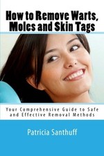 Remove warts moles for sale  UK
