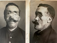 Photographie médicale origina usato  Spedire a Italy