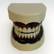 Dental typodont model for sale  Mansfield