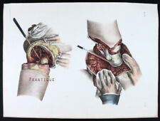 1866 anatomia umana usato  Urbino