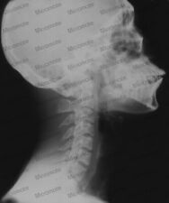 Röntgenfilm scan service gebraucht kaufen  Versand nach Germany