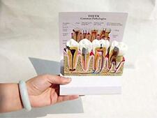 Modelo de dientes y encías con enfermedades anatómicas - higiene dental dental anatomía médica CE segunda mano  Embacar hacia Mexico