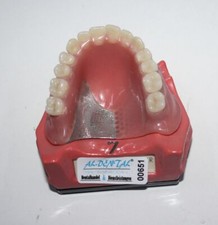 Dent schaumodell . gebraucht kaufen  Ransbach-Baumbach