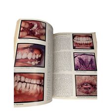 Vintage 1956 Color Atlas Of Oral Pathology Livro de Capa Dura - Kinda Cringey comprar usado  Enviando para Brazil