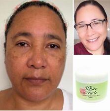 Usado, W.F.C : Eliminan Las Manchas Oscuras, Especial Para Piel Morena o Triguena 2oz. comprar usado  Enviando para Brazil