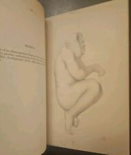 Usado, RARE ANTIQUE MEDICAL BOOK OVER 150 YEARS OLD! SURGERY DISEASES ODDITIES comprar usado  Enviando para Brazil