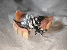dritte zahne gebraucht kaufen dritte zahne gebraucht kaufen Hamburg