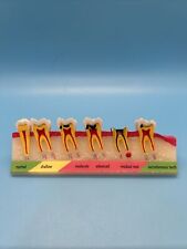 Dental caries developing for sale  Albert Lea