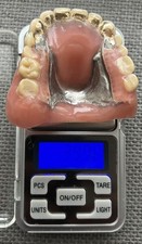 Zahngold zähne gebiss gebraucht kaufen  Korschenbroich