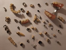 sucata dental 80 gramas comprar usado  Enviando para Brazil