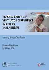 Tracheostomy and Ventilator - Paperback, by Roxann Diez Gross - Very Good comprar usado  Enviando para Brazil