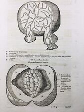 Gynecology 1614 Obstetrics Fertility Rousset Engraving Ambroise Paré comprar usado  Enviando para Brazil