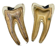 Vintage dentists piece for sale  Colorado Springs