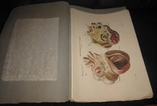 1839 fasc. cruveilhier usato  Roma
