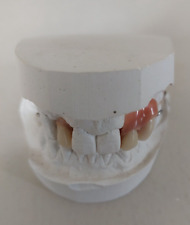 Dentier moulage plâtre d'occasion  Bannalec