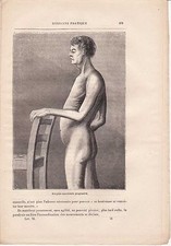 Antique medical engraving d'occasion  Expédié en Belgium