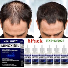 Minoxidil men hair for sale  DERBY