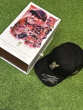 Jurgen klopp hand for sale  LIVERPOOL