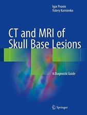 Mri skull base for sale Mri skull base for sale  SAFFRON WALDEN