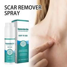 Scar removal spray for sale  Shipping to Ireland