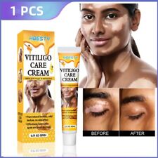 Vitiligo sweat spot d'occasion  Expédié en France