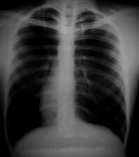 Xray film ray d'occasion  Expédié en Belgium
