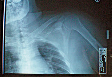 x ray film for sale x ray film for sale Lincolnton